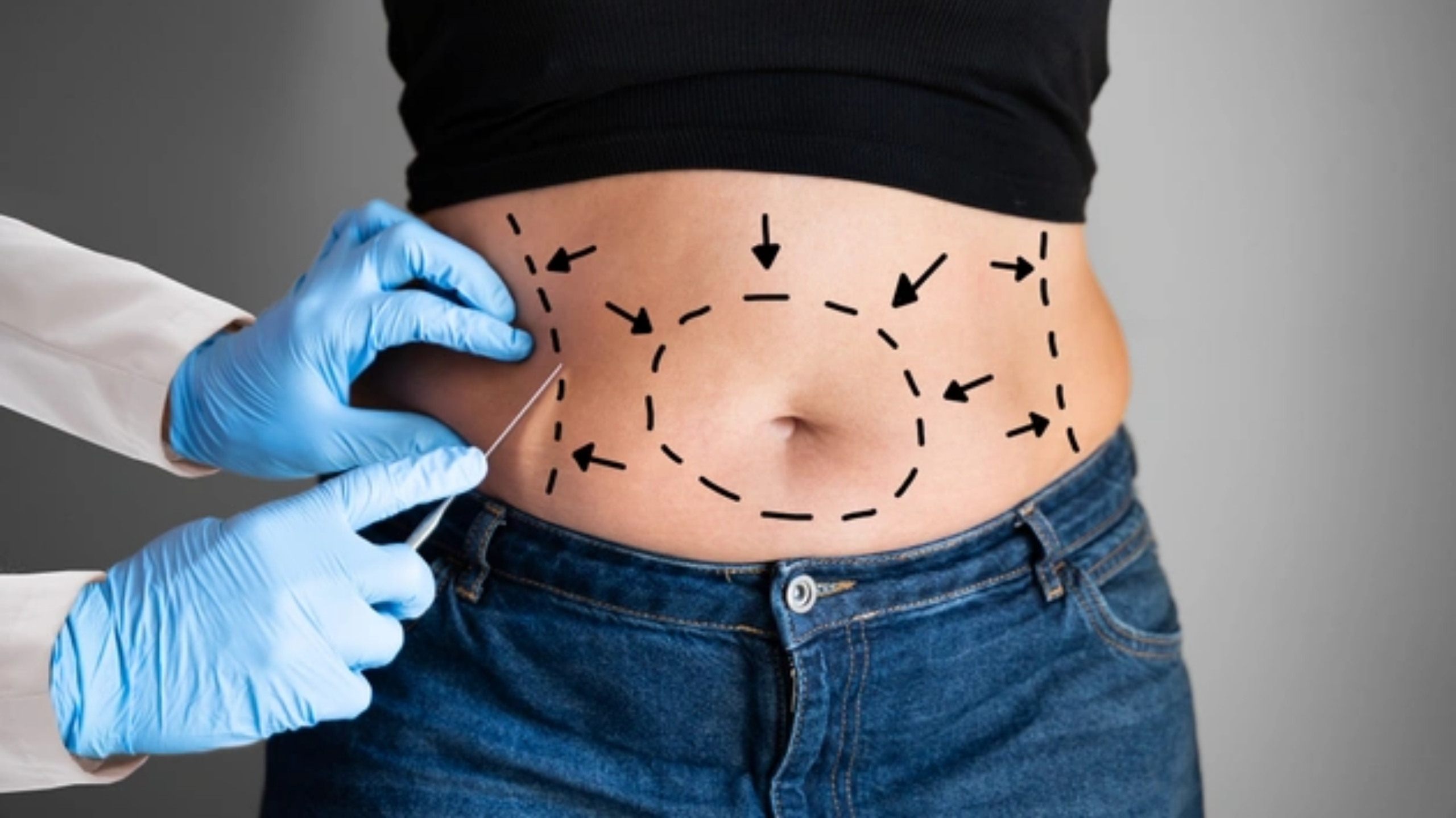 Is Liposuction in Turkey Safe?